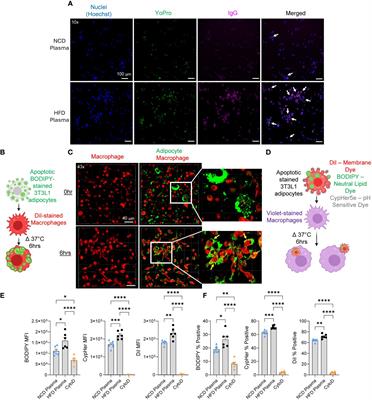 BAFF neutralization impairs the autoantibody-mediated clearance of dead adipocytes and aggravates obesity-induced insulin resistance